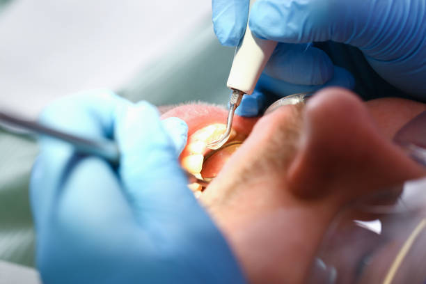 Best Emergency Broken Tooth Repair in Olton, TX