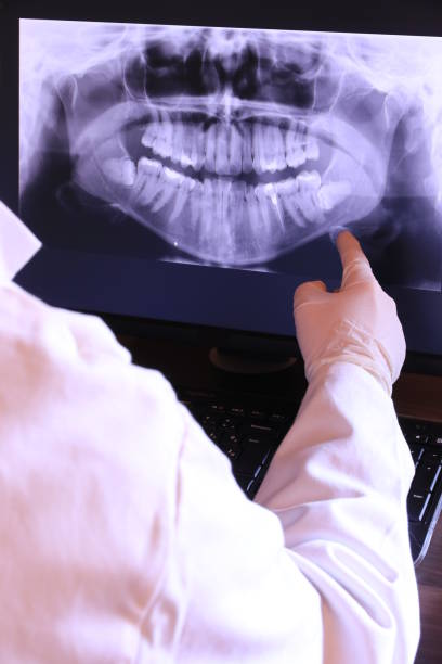 Best Emergency Wisdom Teeth Removal in Olton, TX